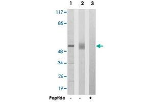 Western blot analysis of extracts from 293 cells (Lane 1) and mouse liver cells (Lane 2 and lane 3), using ACVR1B polyclonal antibody . (Activin A Receptor Type IB/ALK-4 抗体  (AA 73-122))