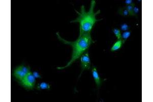 Image no. 4 for anti-Aldehyde Dehydrogenase 1 Family, Member L1 (ALDH1L1) antibody (ABIN1496585)