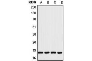 Western blot analysis of UBC9 expression in HeLa (A), A431 (B), Raw264. (UBE2I 抗体  (C-Term))