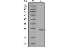 Western Blot showing AXL antibody used against truncated Trx-AXL recombinant protein (1). (AXL 抗体  (AA 466-530))