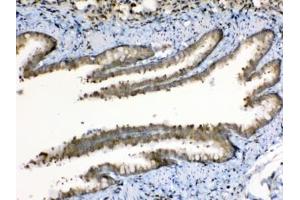 Immunohistochemistry (IHC) image for anti-Periplakin (PPL) (AA 1664-1701) antibody (ABIN5647242)