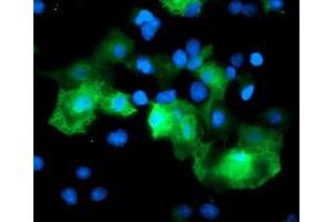 Anti-RFPL3 mouse monoclonal antibody (ABIN2455785) immunofluorescent staining of COS7 cells transiently transfected by pCMV6-ENTRY RFPL3 (RC206518). (RFPL3 抗体)