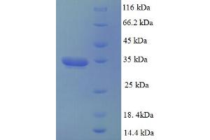 DCTN3 Protein (AA 2-176) (His-SUMO Tag)