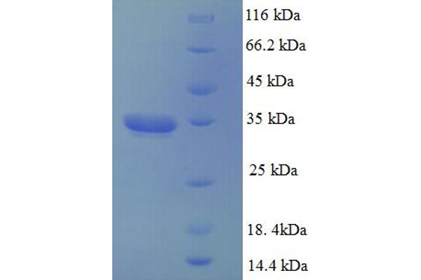 DCTN3 Protein (AA 2-176) (His-SUMO Tag)