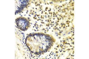 Immunohistochemistry (IHC) image for anti-Mismatch Repair Protein 2 (MSH2) (AA 1-300) antibody (ABIN3021477)