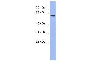 WB Suggested Anti-RBM47 Antibody Titration: 0. (RBM47 抗体  (Middle Region))