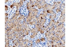 IHC analysis of PCK1/PEPC using anti-PCK1/PEPC antibody (ABIN7599502).