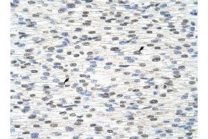 RBM28 antibody was used for immunohistochemistry at a concentration of 4-8 ug/ml to stain Myocardial cells (arrows) in Human Heart. (RBM28 抗体  (C-Term))