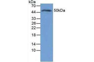 Figure. (IL-6 Receptor 抗体  (AA 19-10))