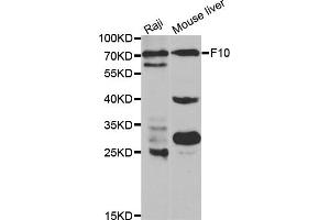 Western blot analysis of extracts of various cell lines, using F10 antibody (ABIN5970678) at 1/1000 dilution.