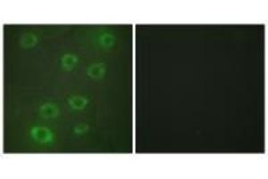 Immunofluorescence analysis of HUVEC cells, using PTX3 antibody. (PTX3 抗体  (N-Term))