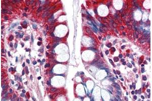 Human Small Intestine (formalin-fixed, paraffin-embedded) stained with ACSL5 antibody ABIN351483 at 2. (ACSL5 抗体  (AA 727-739))