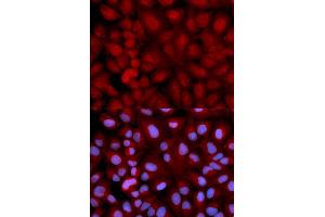 Immunofluorescence analysis of U2OS cells using SNCG antibody (ABIN5971355). (SNCG 抗体)