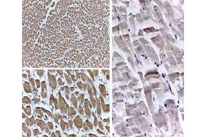 Immunohistochemistry (IHC) image for anti-Peroxisome Proliferator-Activated Receptor delta (PPARD) (N-Term) antibody (ABIN105799)
