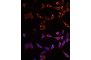 Immunofluorescence (IF) image for anti-Protein tyrosine Phosphatase, Non-Receptor Type 13 (APO-1/CD95 (Fas)-Associated Phosphatase) (PTPN13) (AA 250-500) antibody (ABIN6146442)