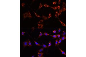 Immunofluorescence analysis of NIH-3T3 cells using PTPN13 Polyclonal Antibody (ABIN6132534, ABIN6146442, ABIN6146443 and ABIN6216830) at dilution of 1:100 (40x lens). (PTPN13 抗体  (AA 250-500))