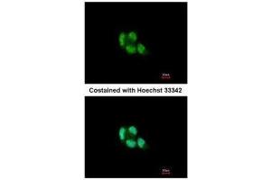 ICC/IF Image Immunofluorescence analysis of paraformaldehyde-fixed A431, using Proteasome 20S beta 5, antibody at 1:200 dilution. (PSMB5 抗体  (C-Term))