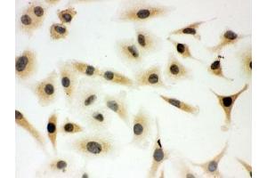 ICC testing of SHC antibody and A549 cells