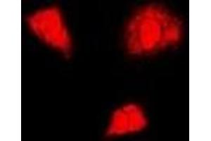 Immunofluorescent analysis of PSMA6 staining in U2OS cells. (PSMA6 抗体)