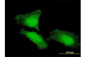 Immunofluorescence (IF) image for anti-Forkhead Box O1 (FOXO1) (AA 556-655) antibody (ABIN560917)