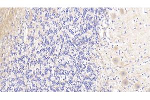 Detection of AGRN in Human Cerebellum Tissue using Polyclonal Antibody to Agrin (AGRN) (AGRN 抗体  (AA 1329-1548))