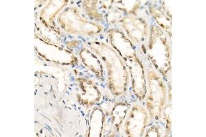 Immunohistochemistry of paraffin-embedded human kidney using [KO Validated] Granulin Rabbit mAb  at dilution of 1:500 (40x lens). (Granulin 抗体)