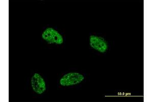Immunofluorescence of monoclonal antibody to DUSP4 on HeLa cell. (DUSP4 抗体  (AA 1-394))