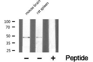 Western blot analysis of extracts of various Tissue ,using TRIM59 antibody. (TRIM59 抗体  (Internal Region))