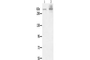 Gel: 6 % SDS-PAGE, Lysate: 40 μg, Lane 1-2: A549 cells, K562 cells, Primary antibody: ABIN7191019(HSPG2 Antibody) at dilution 1/200, Secondary antibody: Goat anti rabbit IgG at 1/8000 dilution, Exposure time: 40 seconds (HSPG2 抗体)