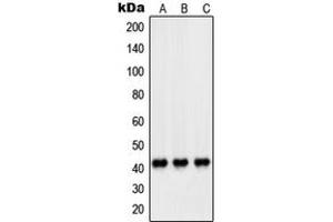 Western blot analysis of PEX14 expression in HeLa (A), HL60 (B), A431 (C) whole cell lysates. (PEX14 抗体  (Center))