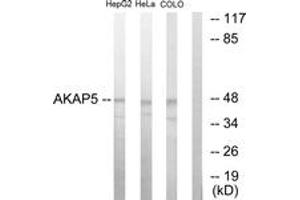 Western blot analysis of extracts from HepG2/HeLa/COLO205 cells, using AKAP5 Antibody. (AKAP5 抗体  (AA 1-50))