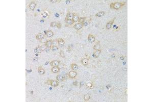 Immunohistochemistry of paraffin-embedded rat brain using CHMP1B antibody. (CHMP1B 抗体  (AA 1-199))