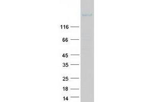 ROBO2 Protein (Transcript Variant 1) (Myc-DYKDDDDK Tag)