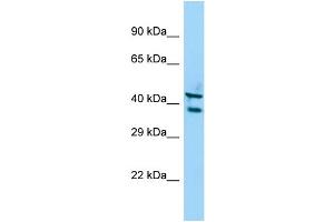 Host: Rabbit Target Name: STK35 Sample Type: A549 Whole Cell lysates Antibody Dilution: 1. (STK35 抗体  (C-Term))