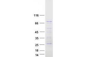 Western Blotting (WB) image for Mitogen-Activated Protein Kinase Kinase Kinase 7 (MAP3K7) (Transcript Variant A) protein (Myc-DYKDDDDK Tag) (ABIN2733206)