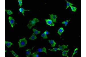 Immunofluorescence staining of SH-SY5Y cells with ABIN7140086 at 1:50, counter-stained with DAPI. (DCHS1 抗体  (AA 2964-2981))