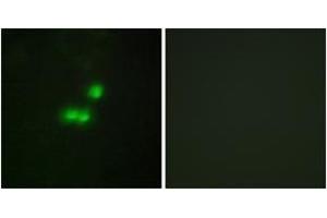 Immunofluorescence analysis of MCF7 cells, using TF3B Antibody. (BRF1 抗体  (AA 231-280))
