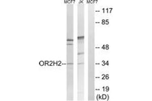 Western blot analysis of extracts from Jurkat/MCF-7 cells, using OR2H2 Antibody. (OR2H2 抗体  (AA 241-290))