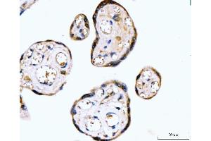 IHC analysis of RYR2 using anti-RYR2 antibody (ABIN7599921).