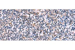 Immunohistochemistry of paraffin-embedded Human tonsil tissue using NMRK2 Polyclonal Antibody at dilution of 1:55(x200) (ITGB1BP3 抗体)