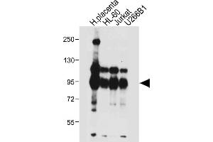 All lanes : Anti-NLRP6 Antibody (N-term) at 1:4000 dilution Lane 1: Human placenta tissue lysate Lane 2: HL-60 whole cell lysate Lane 3: Jurkat whole cell lysate Lane 4: U266B1 whole cell lysate Lysates/proteins at 20 μg per lane. (NLRP6 抗体  (N-Term))