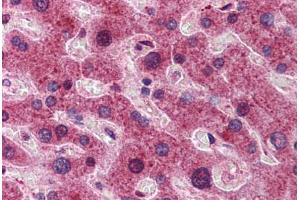 Immunohistochemistry (Formalin-fixed Paraffin-embedded Sections) (IHC (fp)) image for anti-Dynein, Light Chain, LC8-Type 1 (DYNLL1) (N-Term) antibody (ABIN6747135)