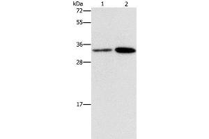 Western Blot analysis of Hela and A431 cell using CDC34 Polyclonal Antibody at dilution of 1:900 (CDC34 抗体)