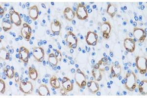 Immunohistochemistry of paraffin-embedded Mouse kidney using CA13 Polyclonal Antibody at dilution of 1:100 (40x lens). (CA13 抗体)