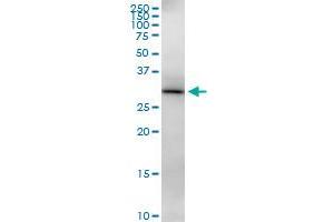 Western Blotting (WB) image for anti-3-hydroxyisobutyrate Dehydrogenase (HIBADH) (AA 1-336) antibody (ABIN524522)
