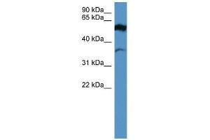 FSCN2 antibody used at 0.