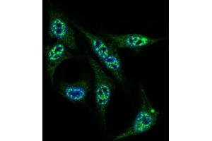 Immunofluorescence analysis of HepG2 cells using INCENP antibody (green). (INCENP 抗体  (AA 369-583))