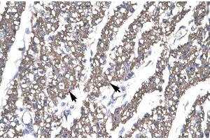 Immunohistochemistry (IHC) image for anti-SMAD, Mothers Against DPP Homolog 6 (SMAD6) (N-Term) antibody (ABIN2779804)