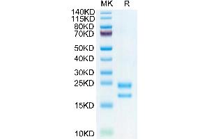 SDS-PAGE (SDS) image for Vascular Endothelial Cell Growth Factor 121 (VEGF121) (AA 27-147) protein (His-Avi Tag,Biotin) (ABIN7275826)