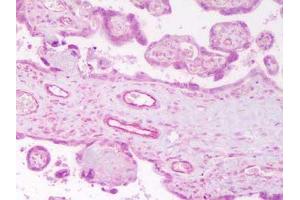 Immunohistochemistry (IHC) image for anti-Angiopoietin 2 (ANGPT2) (N-Term) antibody (ABIN95113)